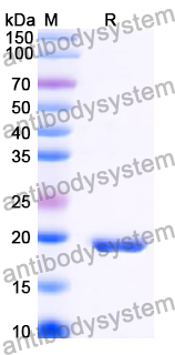 Recombinant Human MBIP Protein, N-His-SUMO & C-Strep