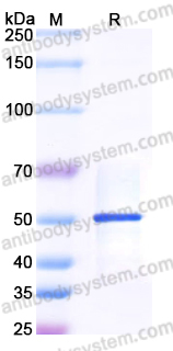 Recombinant Human MBIP Protein, N-His