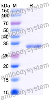 Recombinant Human THAP1 Protein, N-GST & C-His