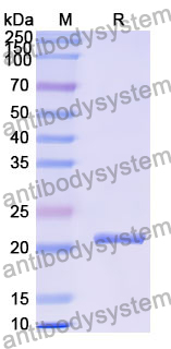 Recombinant Human GPRIN1 Protein, N-His-SUMO