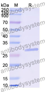 Recombinant Human CHSY1 Protein, N-His