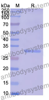 Recombinant Human FBXO17 Protein, N-His