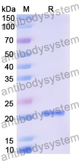 Recombinant Human KCNJ15 Protein, N-His