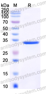 Recombinant Human SULT4A1 Protein, Tag free