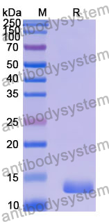 Recombinant Human TMED9 Protein, N-His