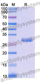 Recombinant Human KDM5D Protein, N-His