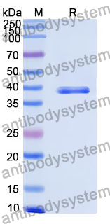 Recombinant Human ZDHHC5 Protein, N-GST & C-His