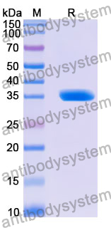 Recombinant Human KLC2 Protein, N-His
