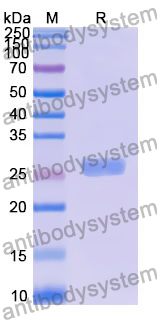 Recombinant Human PLK3 Protein, N-His