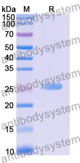 Recombinant Human RMI1 Protein, N-His