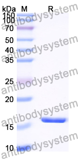 Recombinant Human VSTM2A Protein, N-His