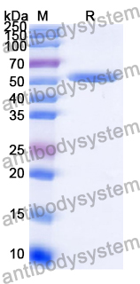 Recombinant Human ADAM32 Protein, N-His