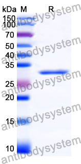 Recombinant Human SLC20A1 Protein, N-His