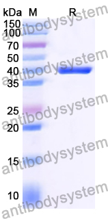 Recombinant Human CATSPERB Protein, N-His