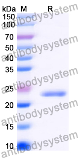 Recombinant Human ATF5 Protein, N-His