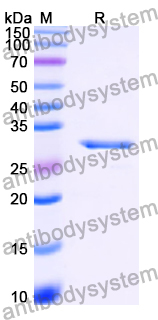 Recombinant Human SPG11/Spatacsin Protein, N-His