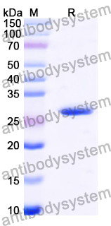 Recombinant Human USP31 Protein, N-His