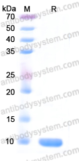 Recombinant Human NRN1/Neuritin Protein, N-His