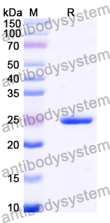 Recombinant Human ITPRIPL1 Protein, N-His-KSI