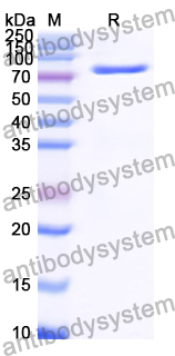 Recombinant Human SUPV3L1 Protein, N-His