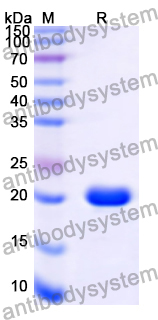 Recombinant Human YTHDF3 Protein, N-His