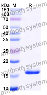 Recombinant Human UBAP1 Protein, N-His