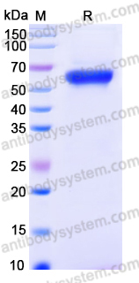 Recombinant Human UBAP1 Protein, C-His