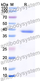 Recombinant Human MARK4 Protein, N-His