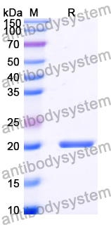 Recombinant Human PACS2 Protein, N-His