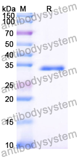 Recombinant Human ATG2B Protein, N-His