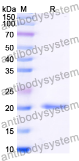 Recombinant Human GPX7 Protein, N-His