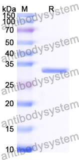Recombinant Human KLHL3 Protein, N-His