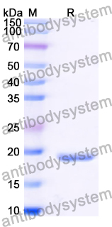 Recombinant Human MTA3 Protein, N-His