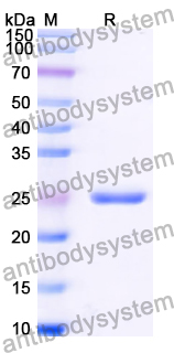 Recombinant Human NUFIP1 Protein, N-His-SUMO & C-Strep