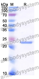 Recombinant Human USP33 Protein, N-His-SUMO & C-Strep