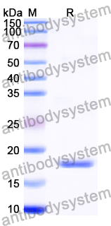 Recombinant Human FAF2 Protein, N-His
