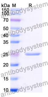 Recombinant Human LRATD2 Protein, N-His