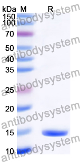 Recombinant Human USP37 Protein, N-His