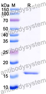 Recombinant Human WWP1 Protein, N-His