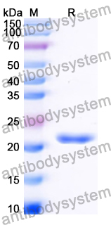 Recombinant Human TSPYL2 Protein, N-His
