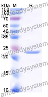 Recombinant Human DNAJC19 Protein, N-His-SUMO & C-Strep