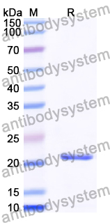 Recombinant Human INTS8 Protein, N-His