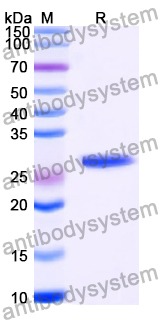 Recombinant Human LZTS2 Protein, N-His