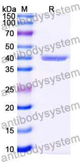 Recombinant Human GTSE1 Protein, N-GST & C-His