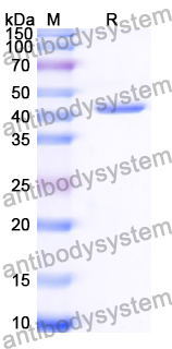 Recombinant Human SDCCAG8 Protein, N-His