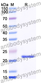 Recombinant Human IRGM Protein, N-His