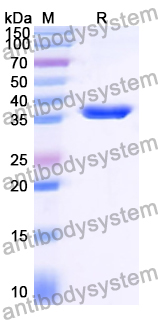 Recombinant Human FAM170A Protein, N-GST & C-His
