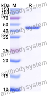 Recombinant Human FSD2 Protein, N-His