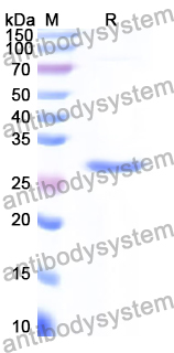 Recombinant Human TARS3 Protein, N-His