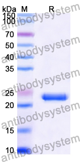 Recombinant Human TESPA1 Protein, N-His